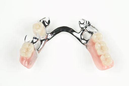 Appareil Dentaire Partiel Levallois